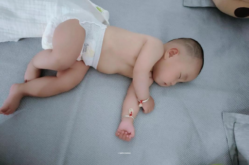 桂阳六个月宝宝眼睛散光 桂阳六个月宝宝眼睛散光